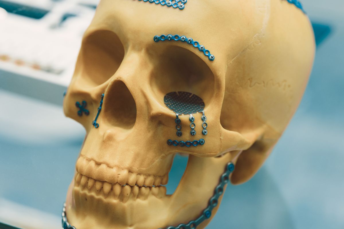 Cirurgia e Traumatologia Bucomaxilofacial — Forma Odontologia Digital Moema São Paulo