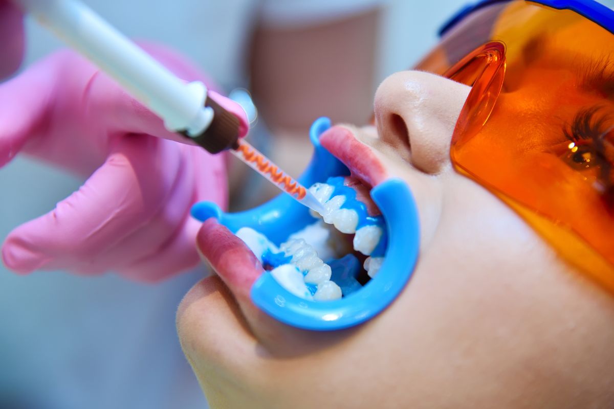 Clareamento Dental em Moema São Paulo — Forma Odontologia Digital