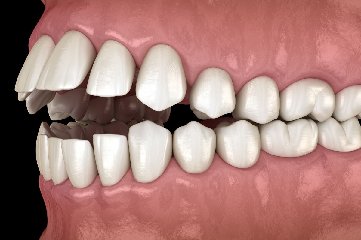 Exame de Ajuste Oclusal Digital — Forma Odontologia Digital Moema São Paulo