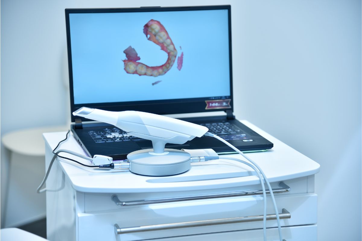Câmera Intra-Oral — Forma Odontologia Digital Moema São Paulo