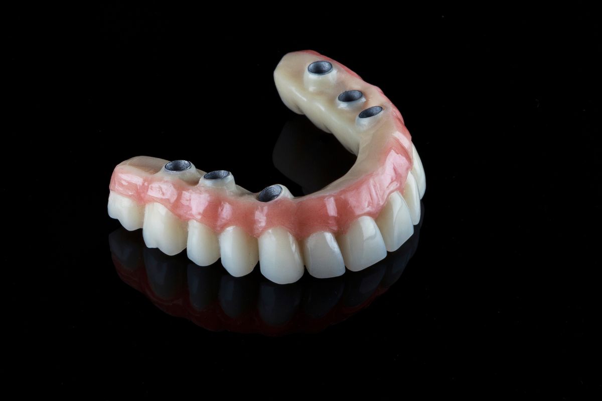 Prótese em Sessão Única CEREC — Forma Odontologia Digital Moema São Paulo