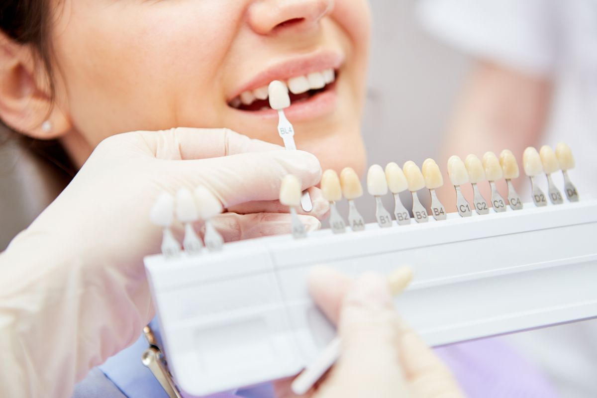 Tratamento para Alteração de Cor do Dente — Forma Odontologia Digital Moema São Paulo