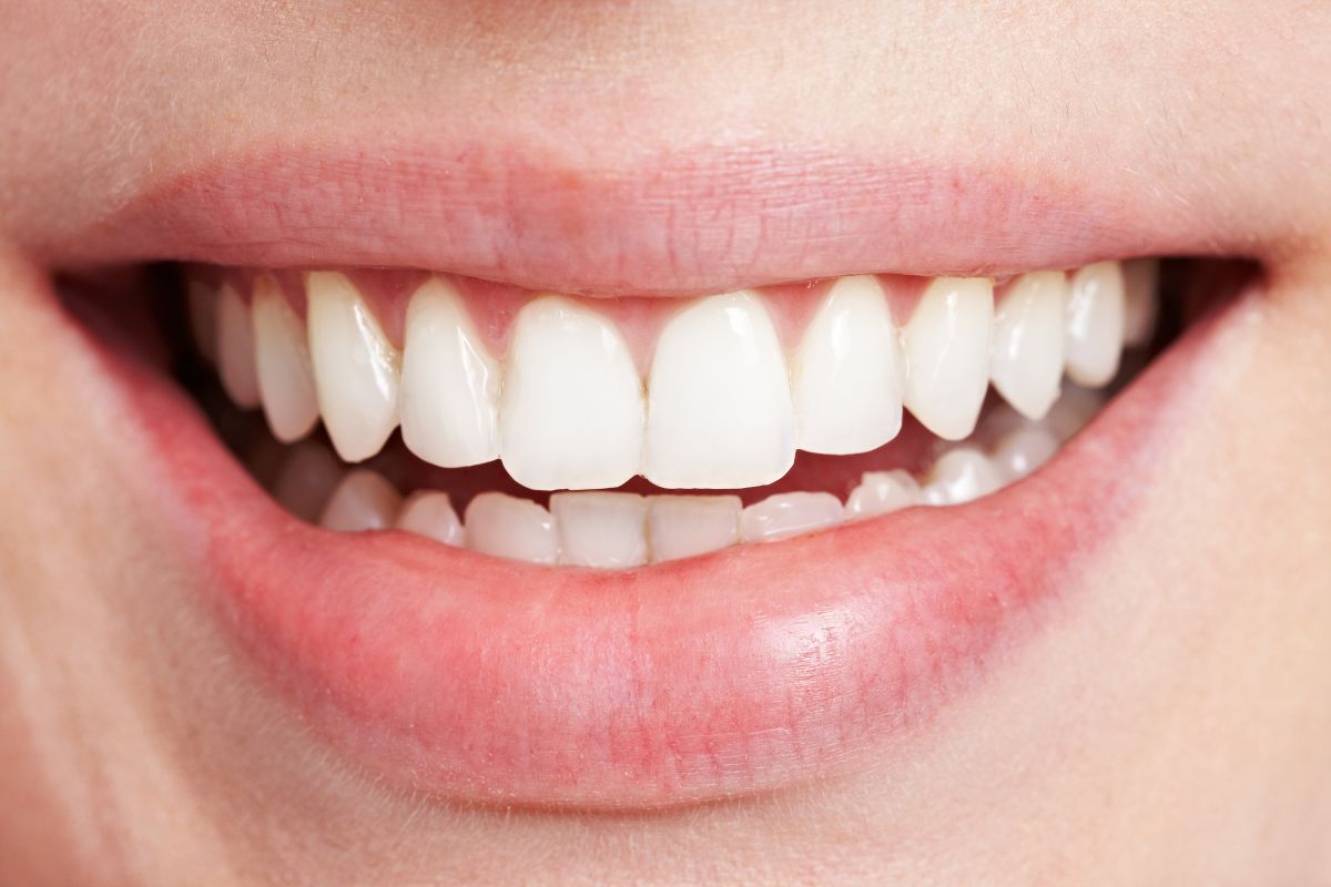 Tratamento para Desgaste dos Dentes — Forma Odontologia Digital Moema São Paulo