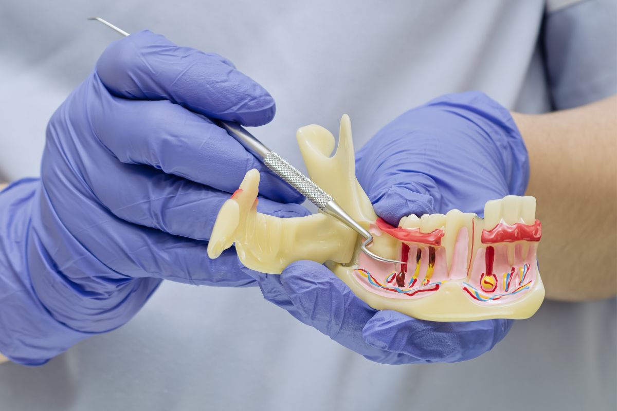 Tratamento Periodontia em Moema São Paulo — Forma Odontologia Digital